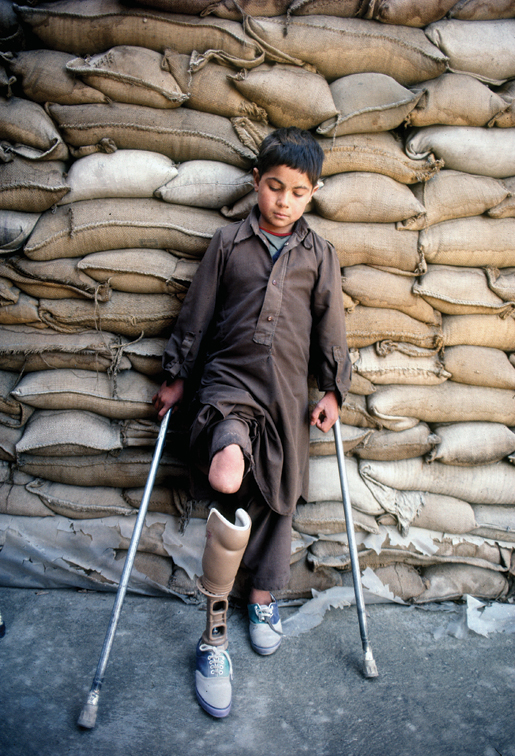 Nine-year-old Wazir Hammond rests against a wall of sandbags that protect a hospital in Kabul, Afghanistan. [PHOTO: ROBERT SEMENIUK]